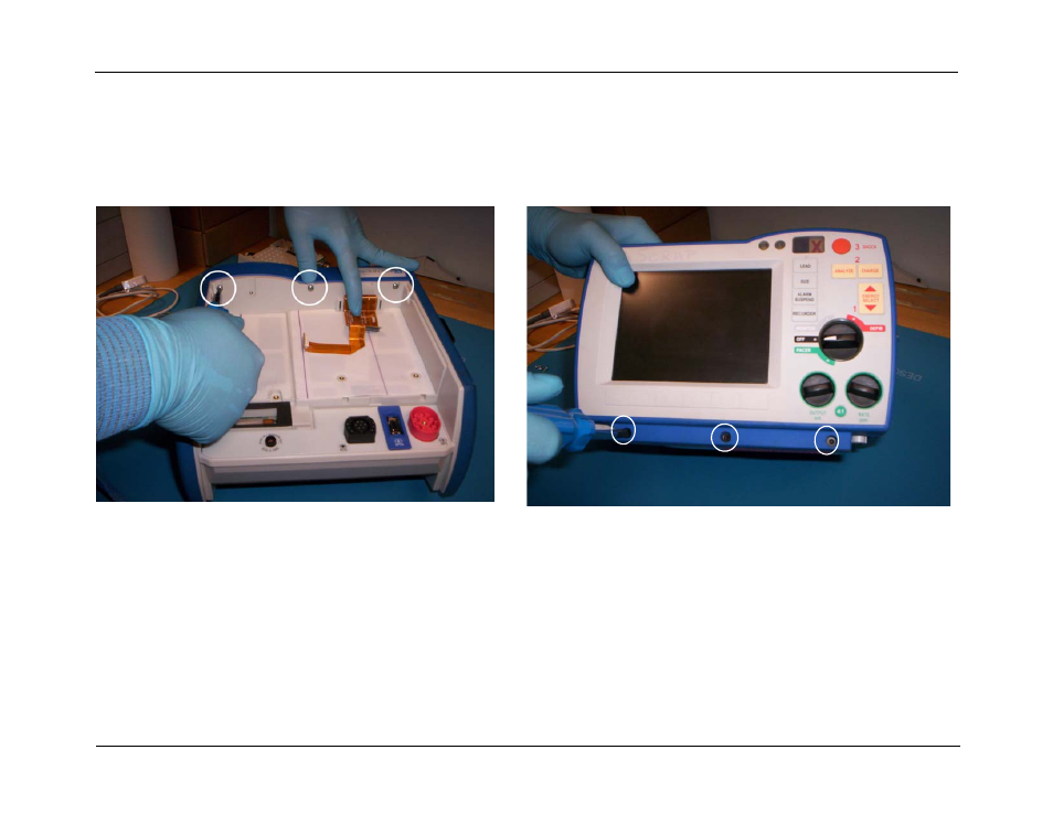 Removing the front panel assembly, Removing the front panel assembly -12 | ZOLL R Series Monitor Defibrillator Rev J User Manual | Page 78 / 538