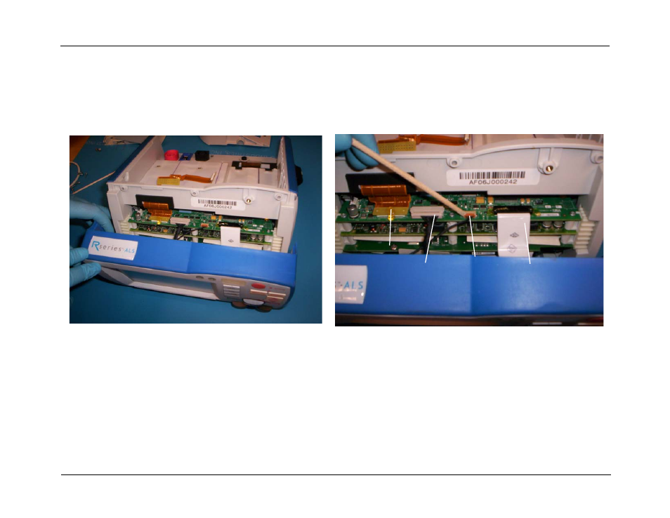 ZOLL R Series Monitor Defibrillator Rev J User Manual | Page 79 / 538