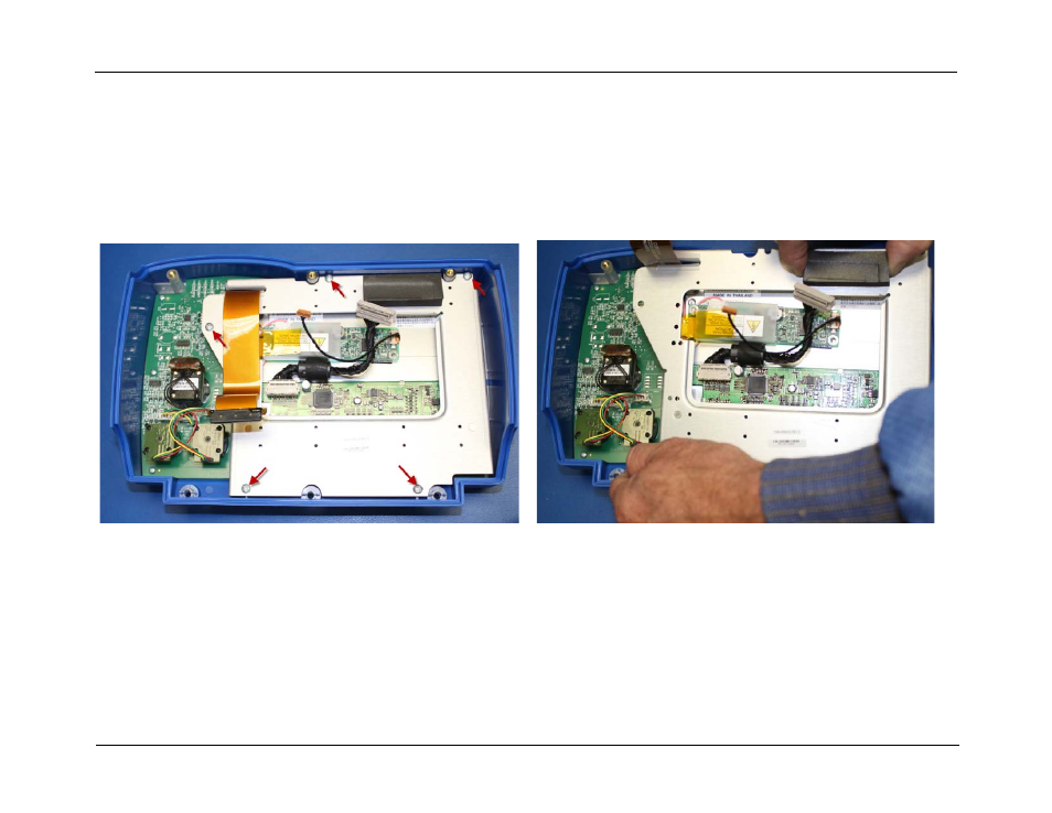 Front panel disassembly, Front panel disassembly -14 | ZOLL R Series Monitor Defibrillator Rev J User Manual | Page 80 / 538