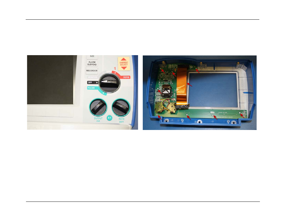 ZOLL R Series Monitor Defibrillator Rev J User Manual | Page 81 / 538