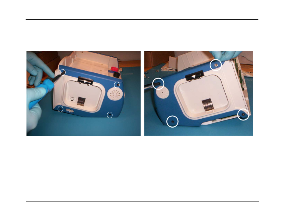 Removing the side panels, Removing the side panels -16 | ZOLL R Series Monitor Defibrillator Rev J User Manual | Page 82 / 538