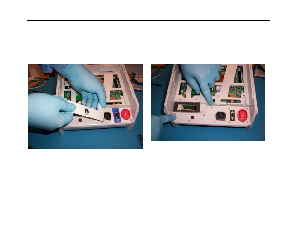 Removing the connector panel and bezel, Removing the connector panel and bezel -18 | ZOLL R Series Monitor Defibrillator Rev J User Manual | Page 84 / 538