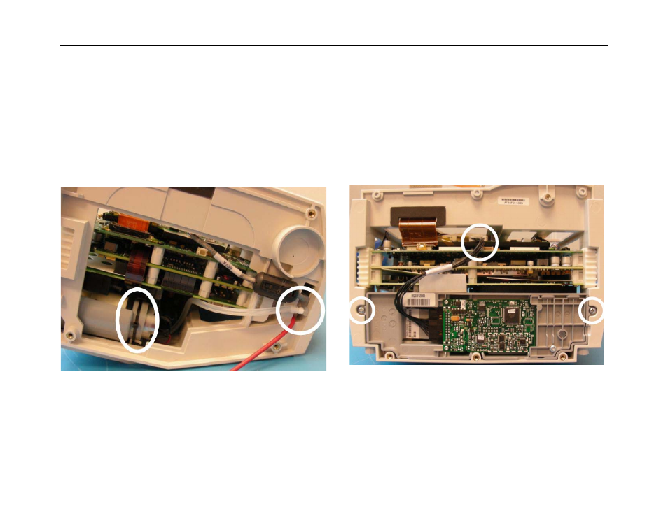 Removing the nibp assembly, Removing the nibp assembly -21 | ZOLL R Series Monitor Defibrillator Rev J User Manual | Page 87 / 538