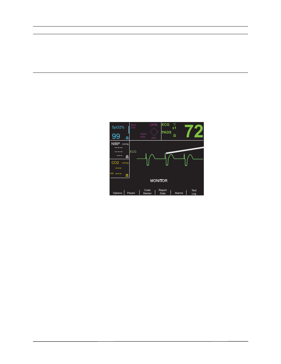 Implanted pacemakers, Lead monitoring | ZOLL R Series Monitor Defibrillator Rev K Operators Guide User Manual | Page 114 / 198