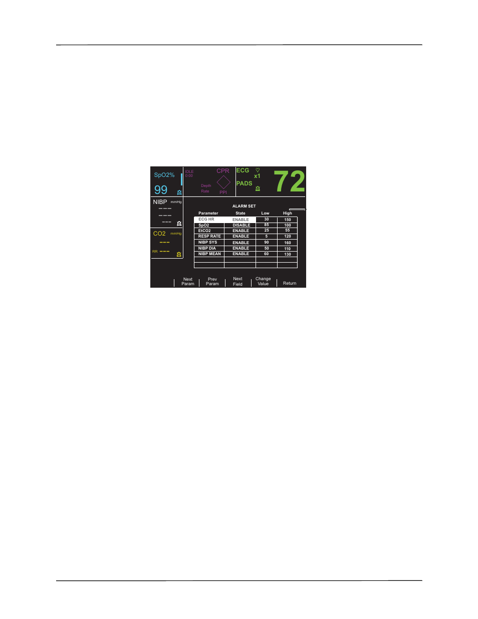 Setting alarm limits, Alarms | ZOLL R Series Monitor Defibrillator Rev K Operators Guide User Manual | Page 117 / 198
