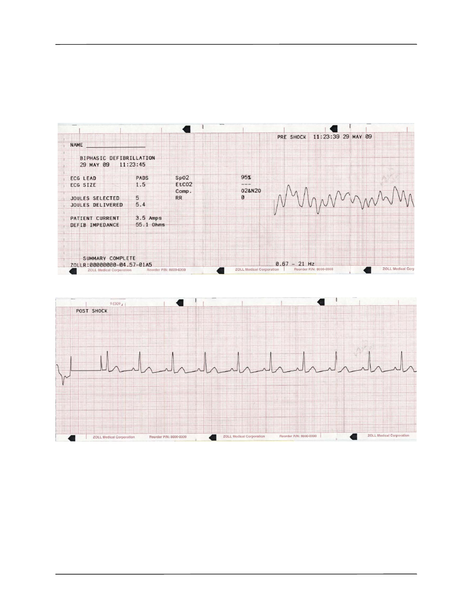 ZOLL R Series Monitor Defibrillator Rev K Operators Guide User Manual | Page 123 / 198