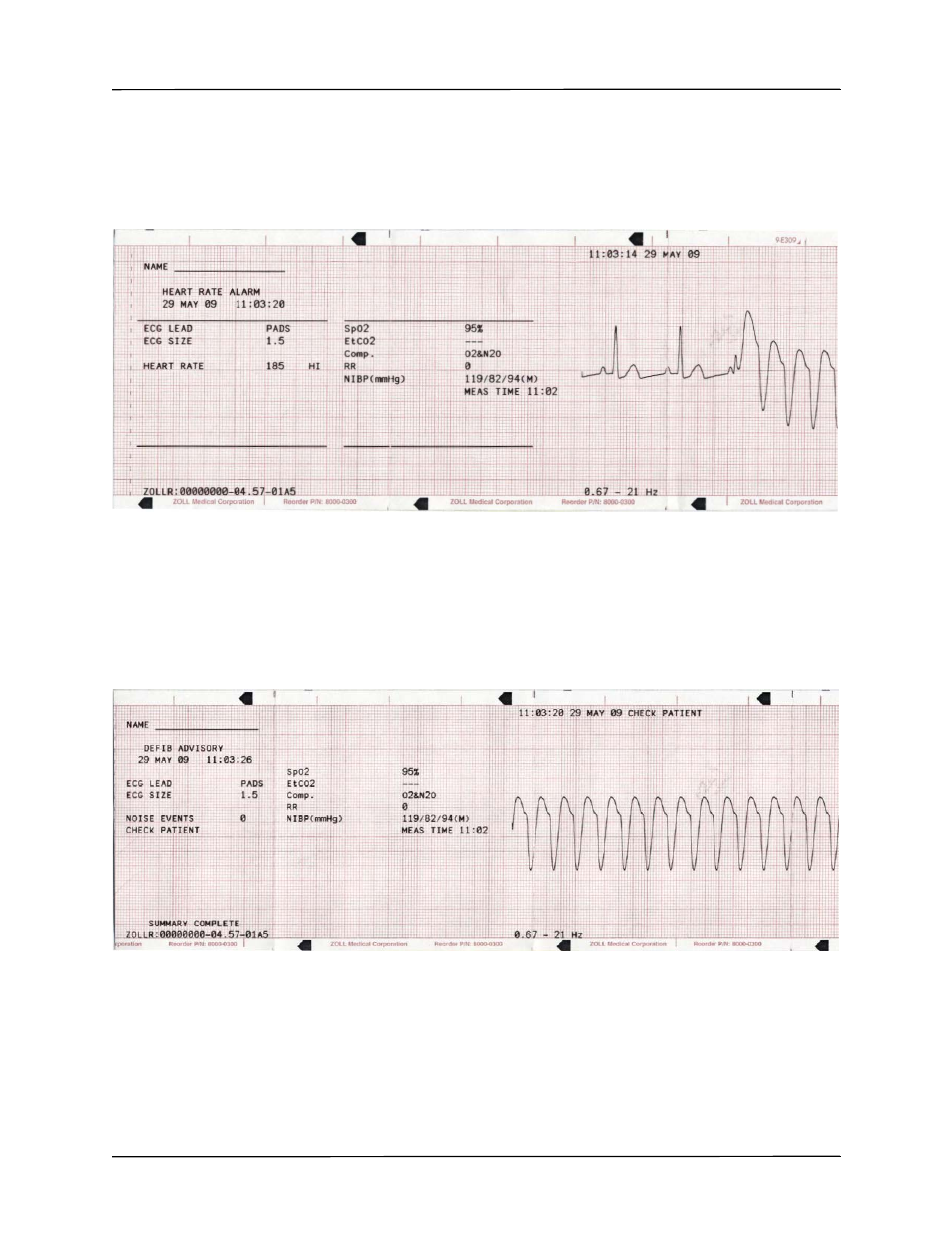ZOLL R Series Monitor Defibrillator Rev K Operators Guide User Manual | Page 125 / 198