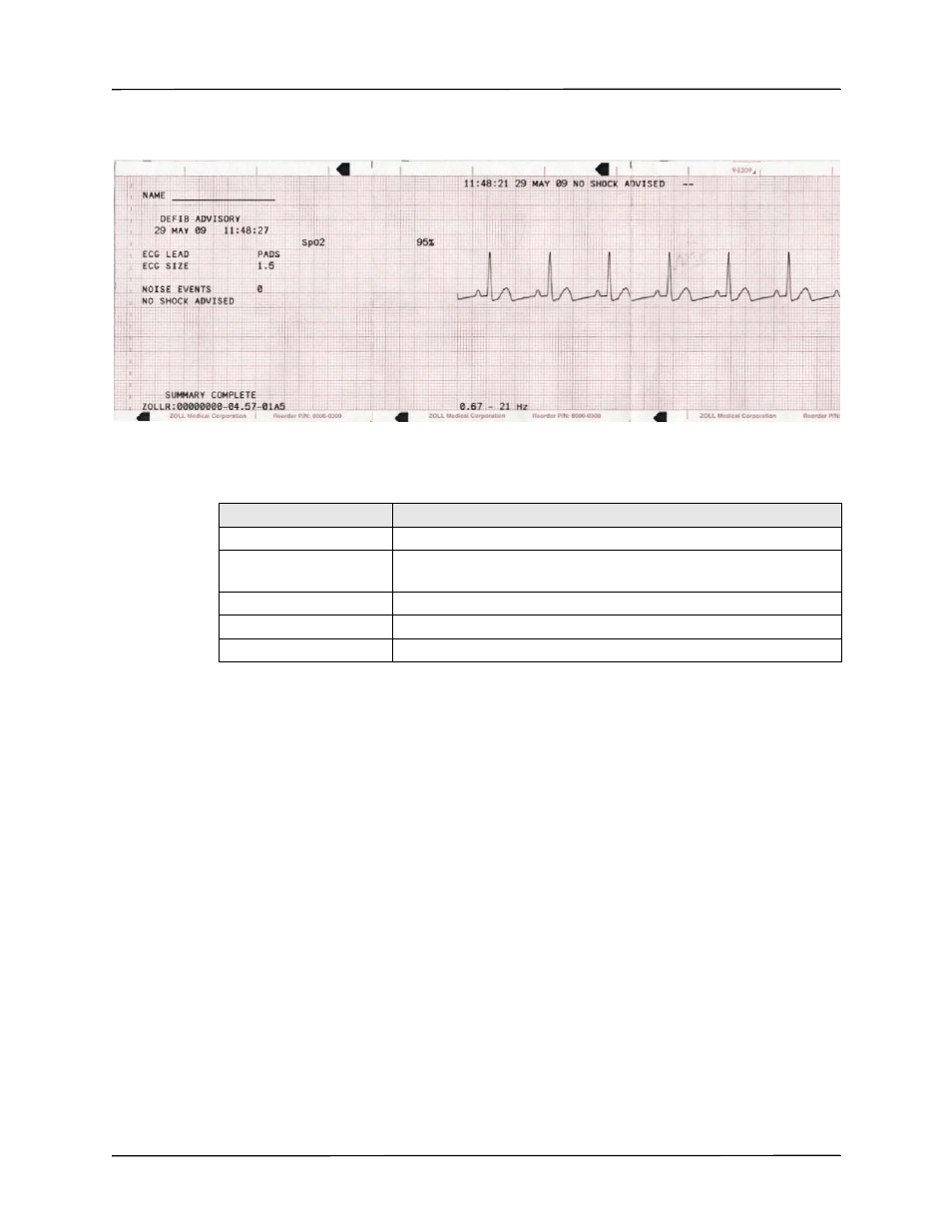 Printing the entire summary report | ZOLL R Series Monitor Defibrillator Rev K Operators Guide User Manual | Page 127 / 198