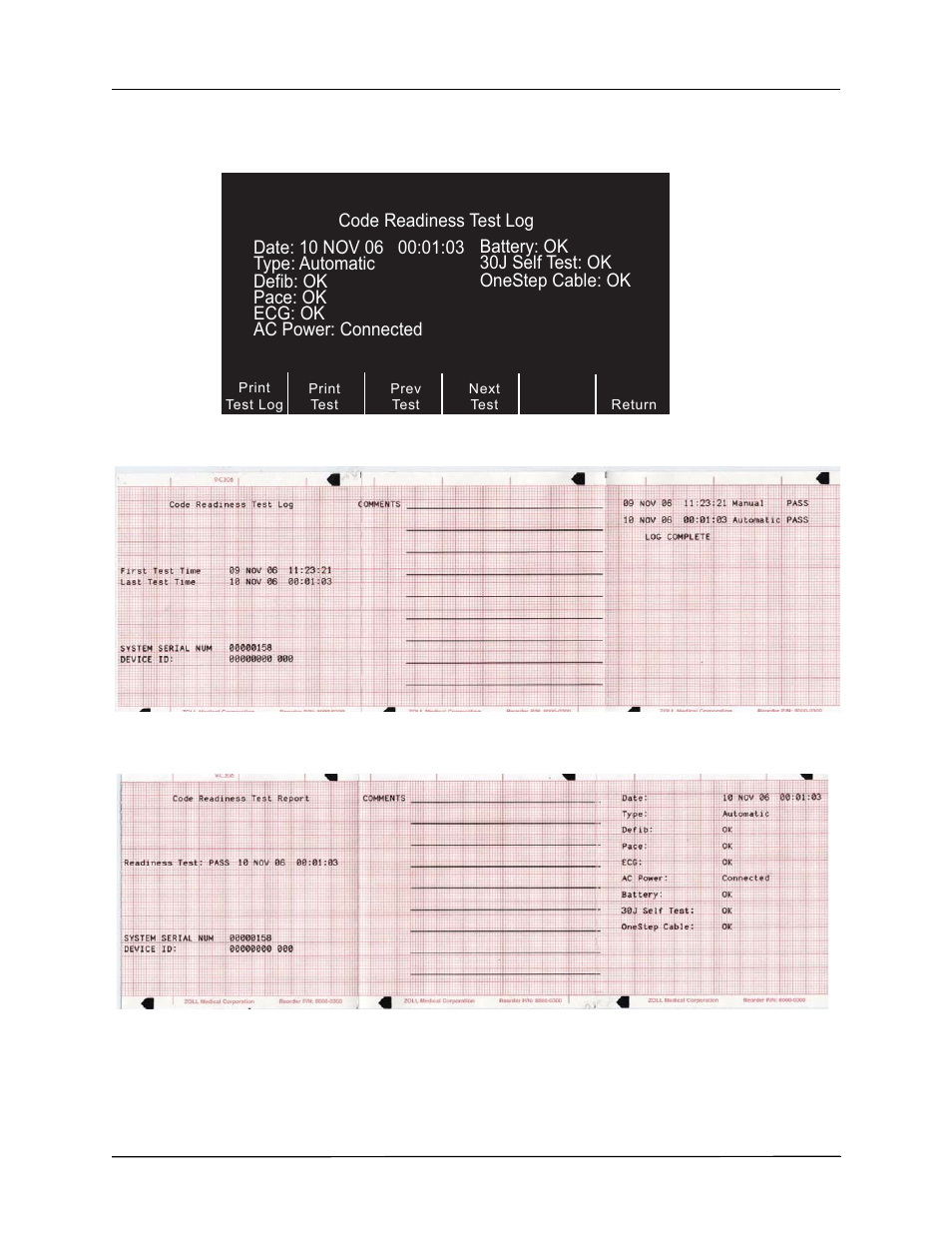 ZOLL R Series Monitor Defibrillator Rev K Operators Guide User Manual | Page 150 / 198