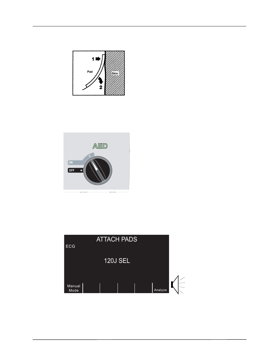 Attach pads, 120j sel, 1 select on | ZOLL R Series Monitor Defibrillator Rev K Operators Guide User Manual | Page 52 / 198