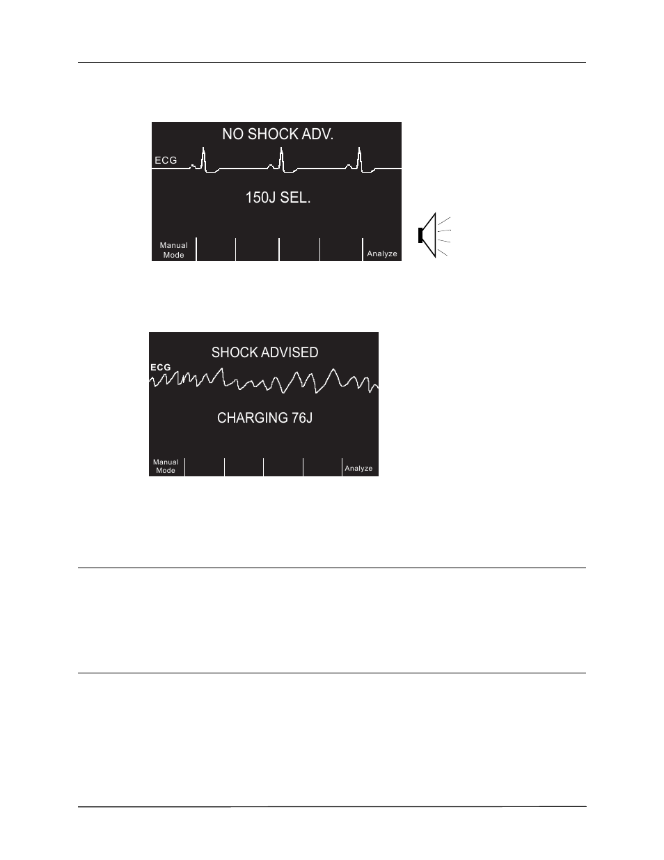 150j sel, No shock adv, 3 press shock | Charging 76j, Shock advised | ZOLL R Series Monitor Defibrillator Rev K Operators Guide User Manual | Page 54 / 198