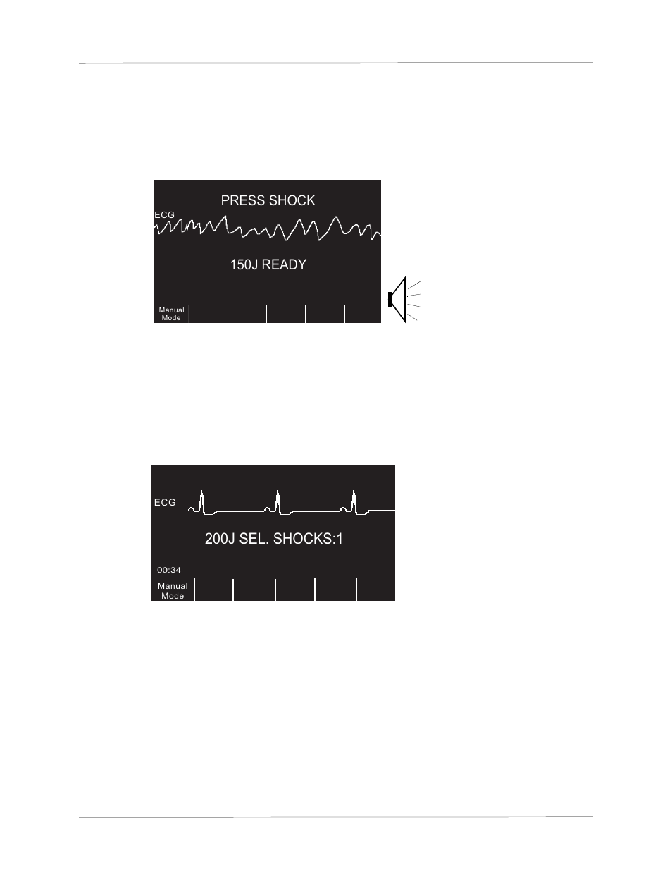 200j sel. shocks:1, 150j ready, Press shock | ZOLL R Series Monitor Defibrillator Rev K Operators Guide User Manual | Page 55 / 198