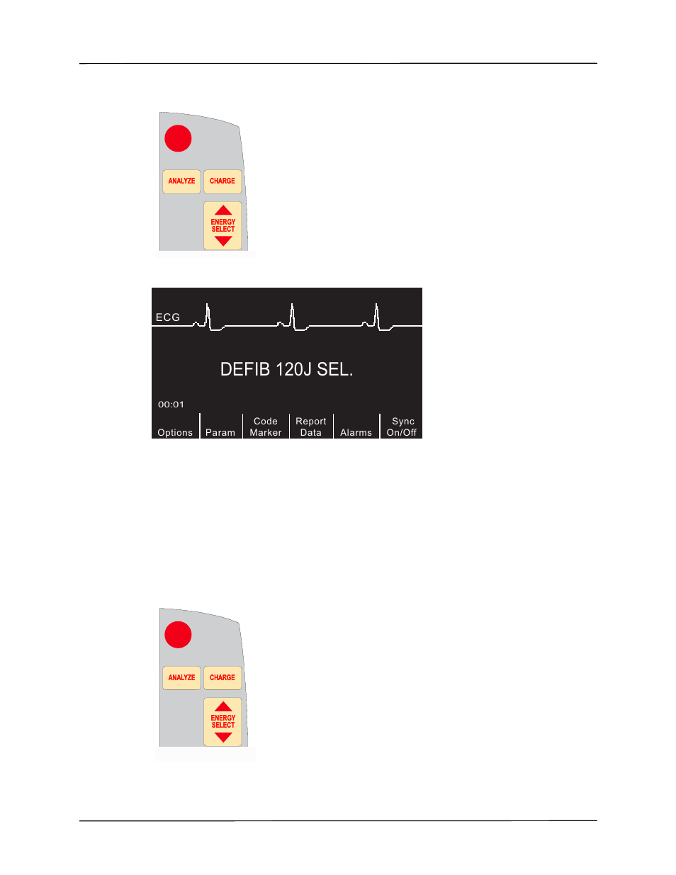 Defib 120j sel, 2 charge defibrillator | ZOLL R Series Monitor Defibrillator Rev K Operators Guide User Manual | Page 69 / 198