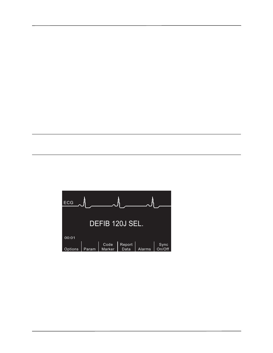 Defib 120j sel | ZOLL R Series Monitor Defibrillator Rev K Operators Guide User Manual | Page 75 / 198