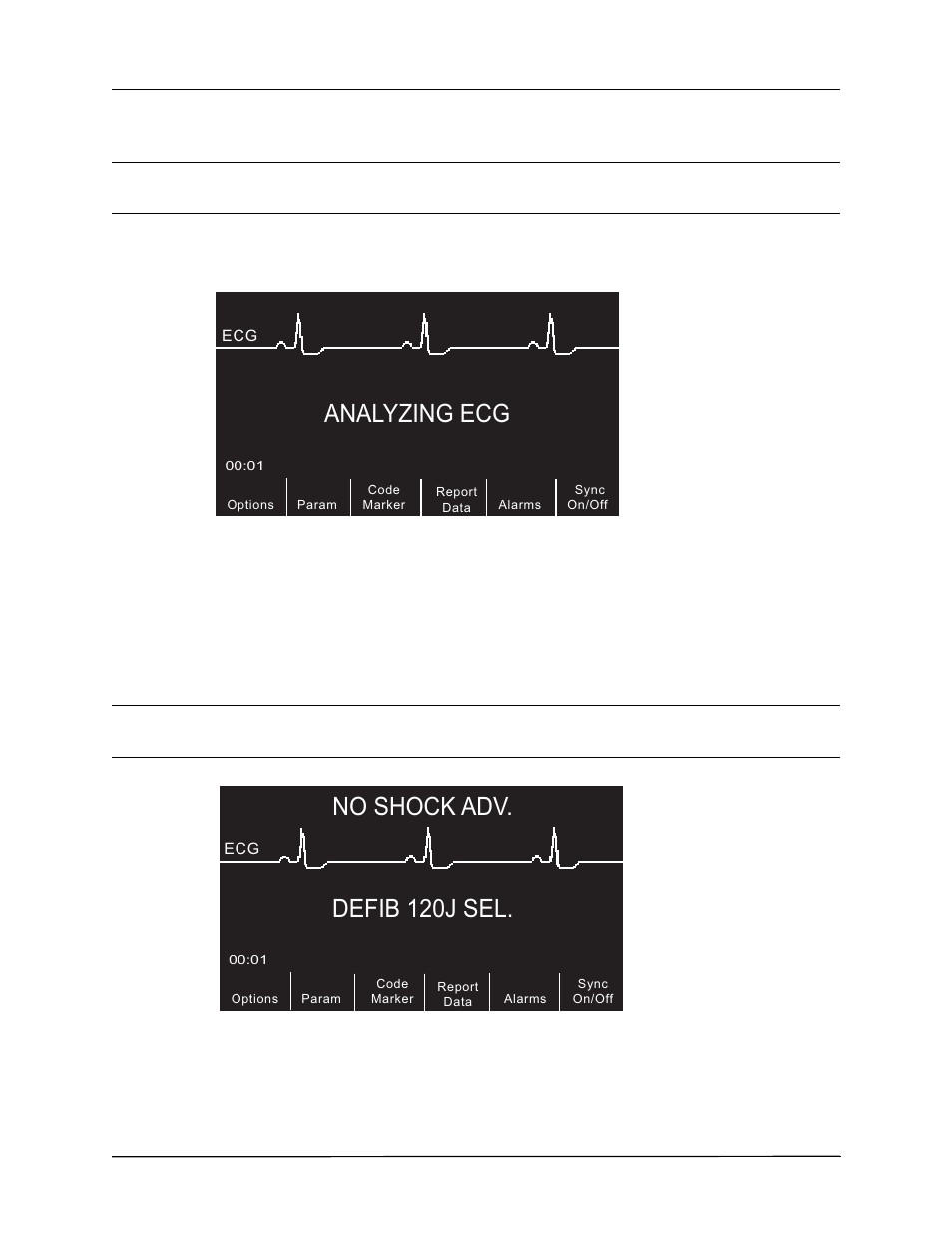 Analyzing ecg, Defib 120j sel, No shock adv | 2 press analyze button | ZOLL R Series Monitor Defibrillator Rev K Operators Guide User Manual | Page 76 / 198