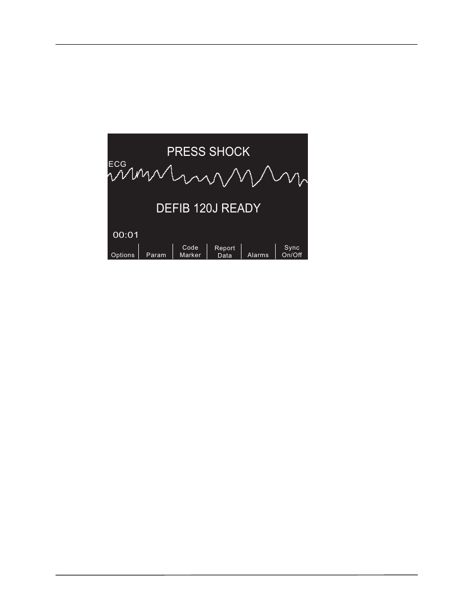 Defib 120j ready, Press shock | ZOLL R Series Monitor Defibrillator Rev K Operators Guide User Manual | Page 78 / 198
