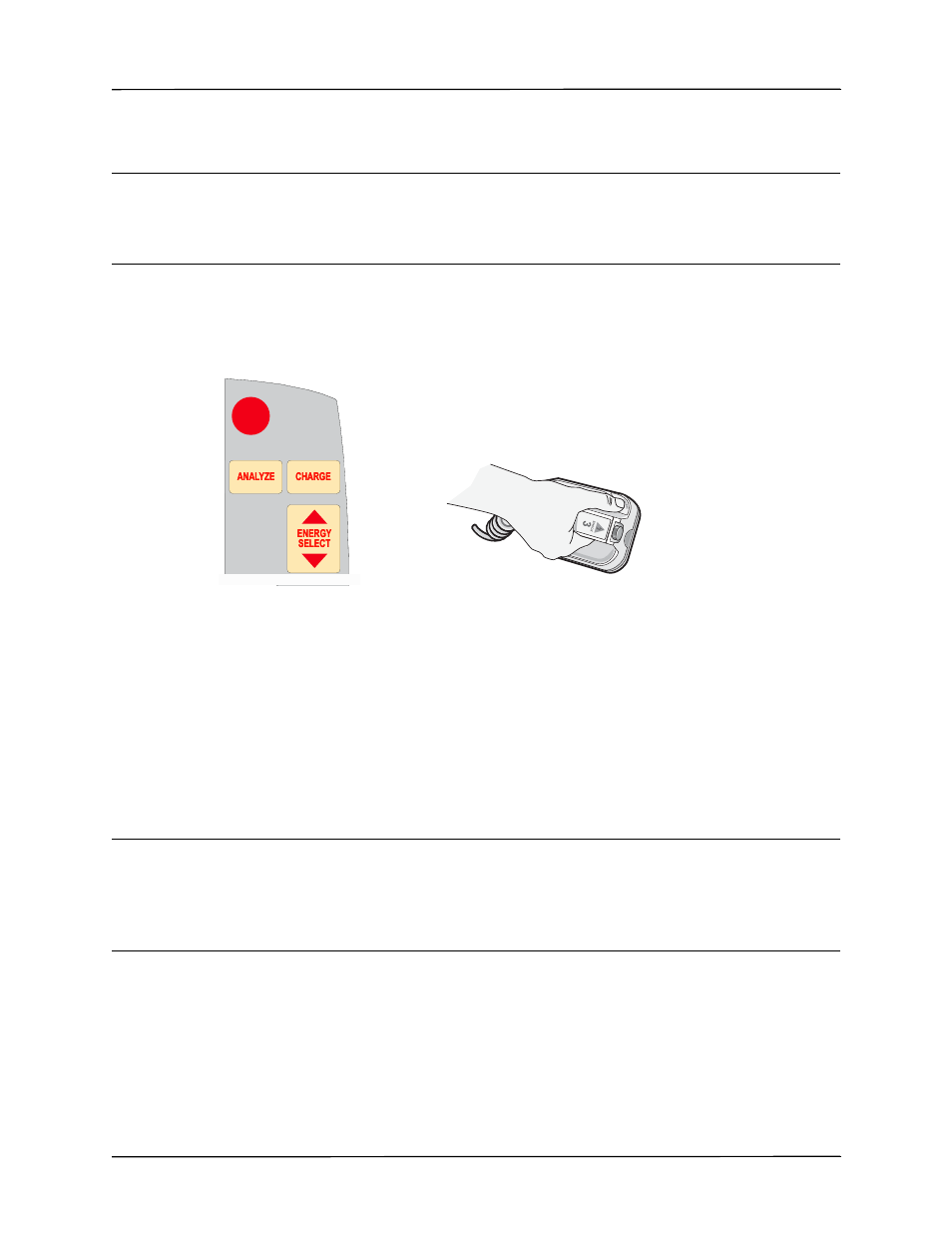 2 charge defibrillator, 3 deliver shock | ZOLL R Series Monitor Defibrillator Rev K Operators Guide User Manual | Page 87 / 198