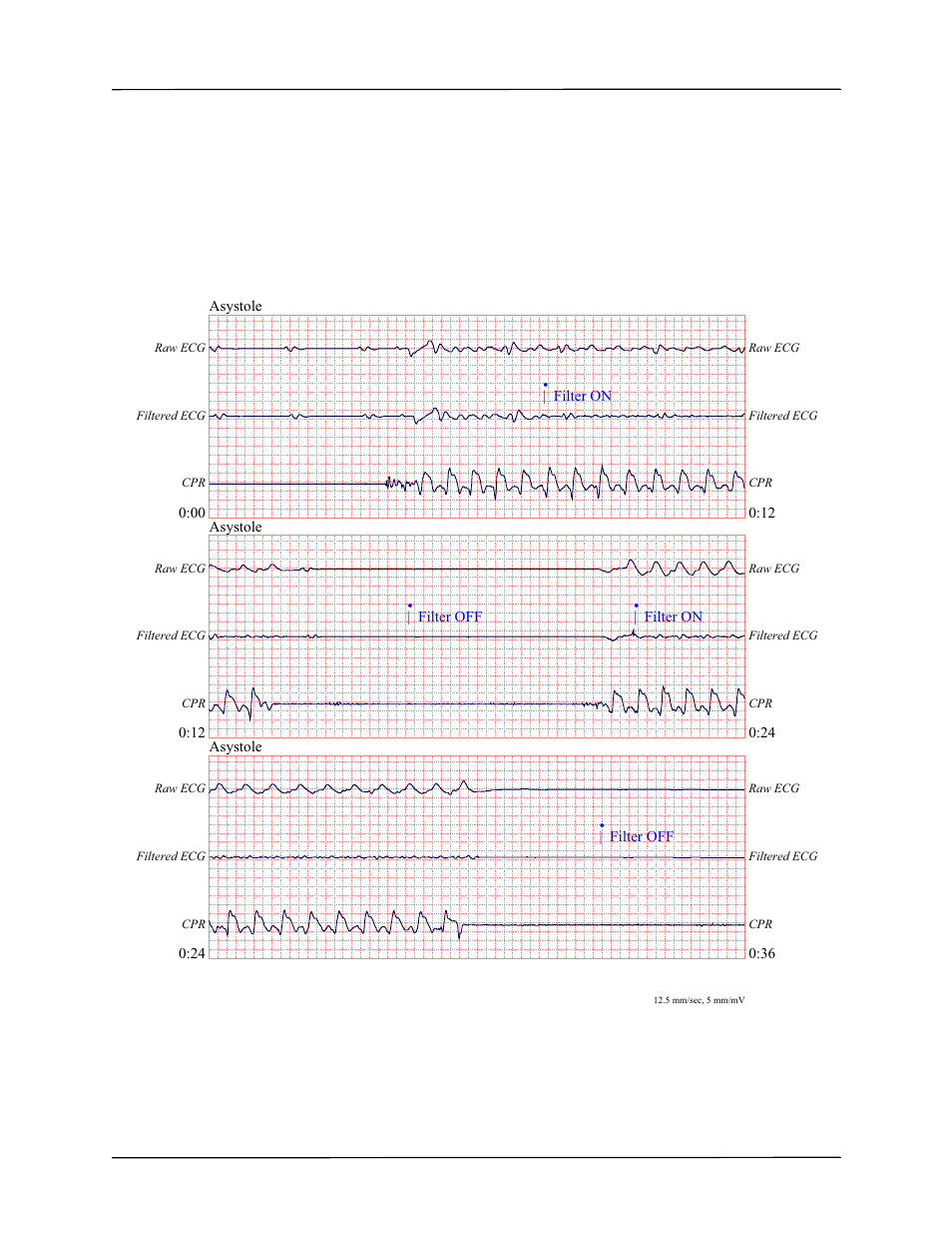 ZOLL R Series Monitor Defibrillator Rev K Operators Guide User Manual | Page 97 / 198