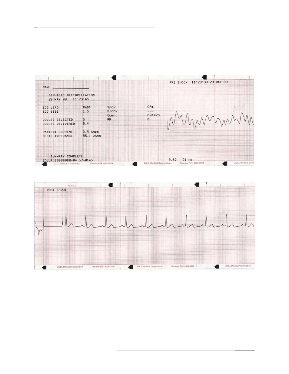 ZOLL R Series Monitor Defibrillator Rev K Operators Guide User Manual | Page 103 / 176