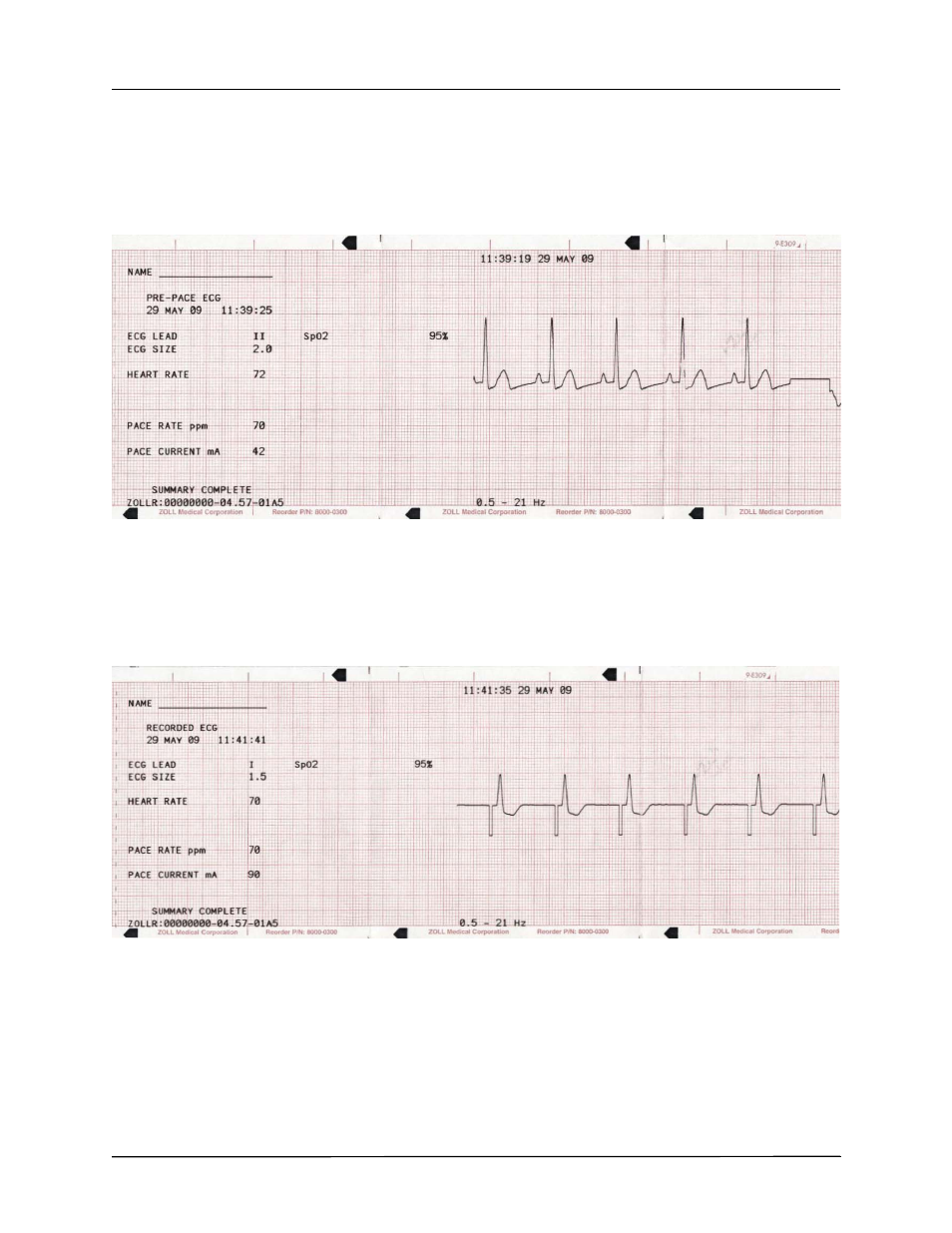 ZOLL R Series Monitor Defibrillator Rev K Operators Guide User Manual | Page 104 / 176