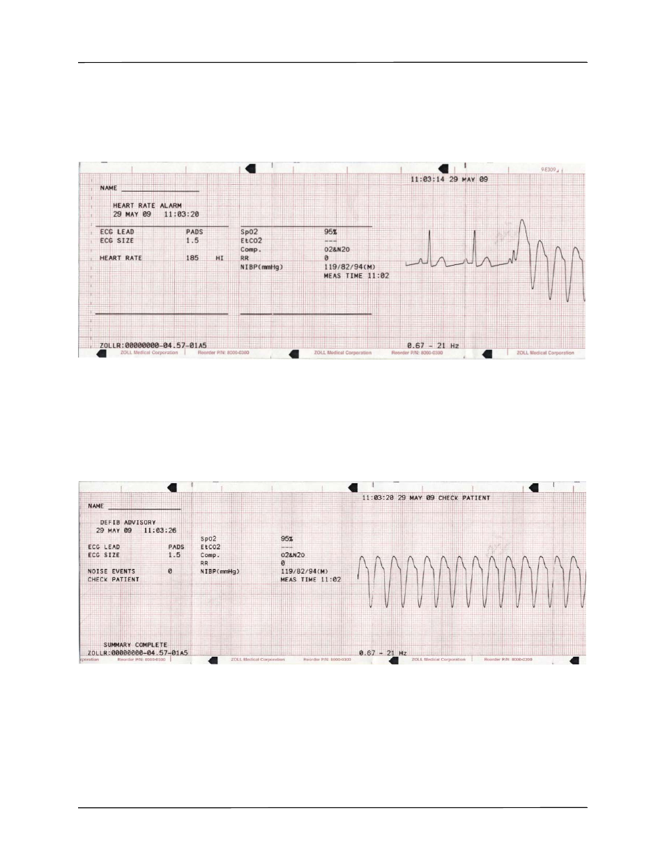 ZOLL R Series Monitor Defibrillator Rev K Operators Guide User Manual | Page 105 / 176