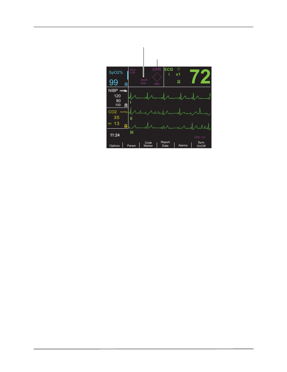 Color coding, Messages | ZOLL R Series Monitor Defibrillator Rev K Operators Guide User Manual | Page 36 / 176