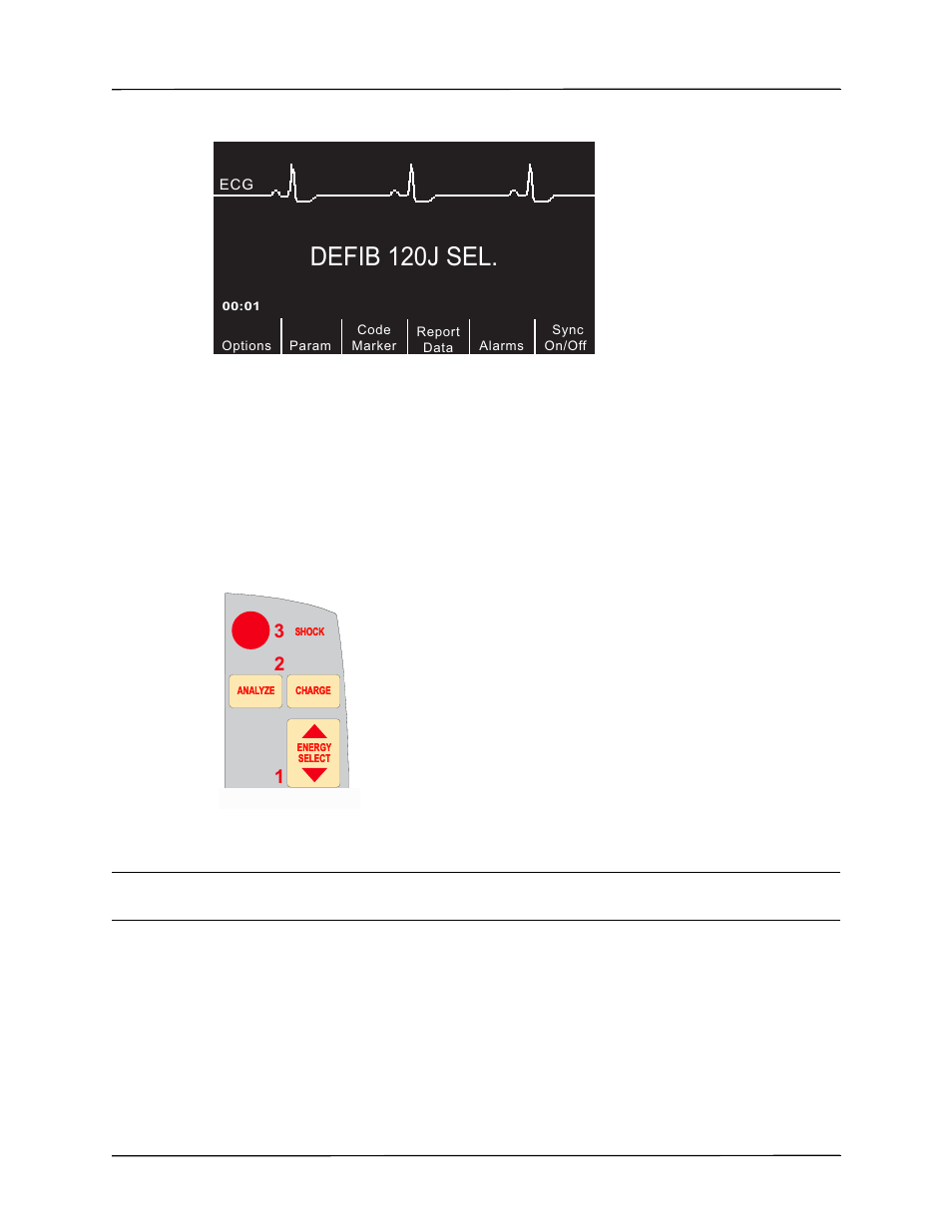 Defib 120j sel, 2 charge defibrillator | ZOLL R Series Monitor Defibrillator Rev K Operators Guide User Manual | Page 53 / 176