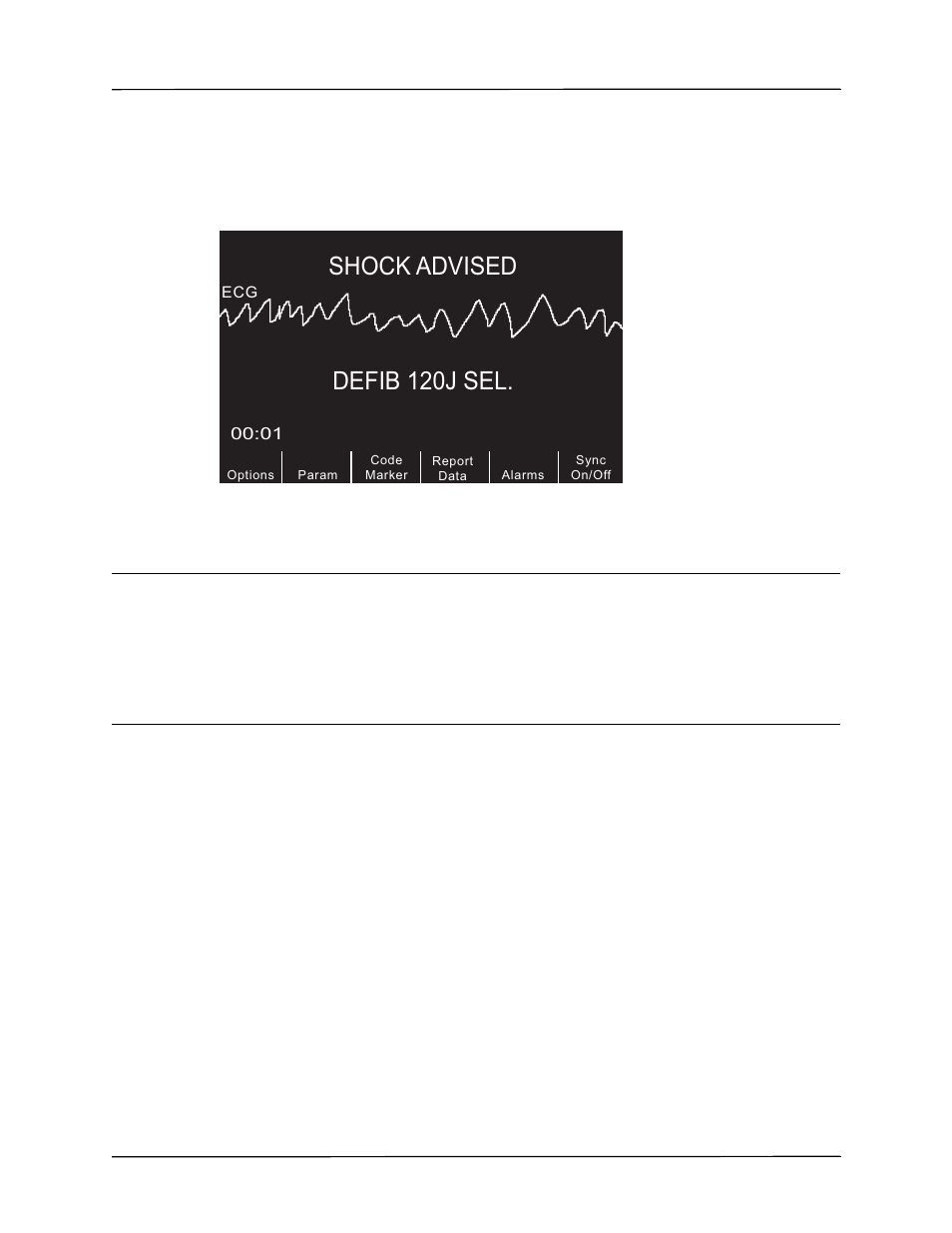 Defib 120j sel, Shock advised, 3 press shock | ZOLL R Series Monitor Defibrillator Rev K Operators Guide User Manual | Page 59 / 176