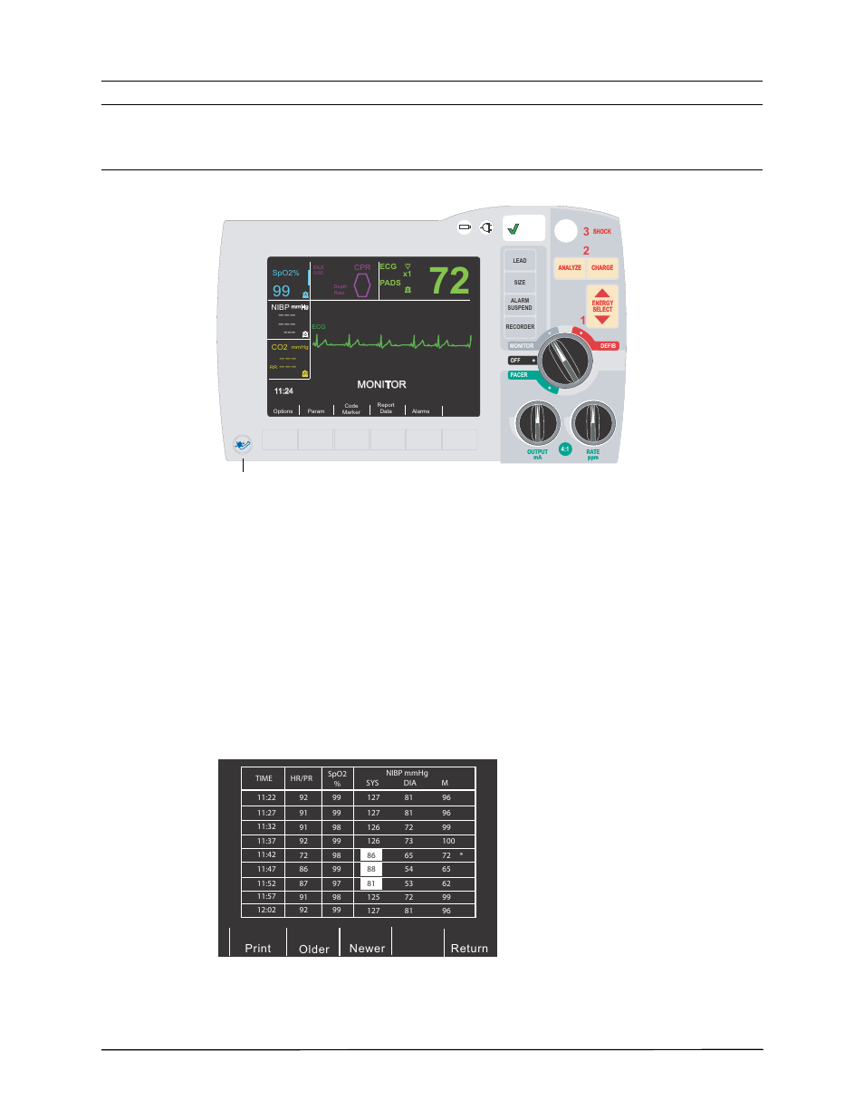 Viewing trend data, Nibp) o | ZOLL R Series Monitor Defibrillator Rev A NIBP User Manual | Page 22 / 28