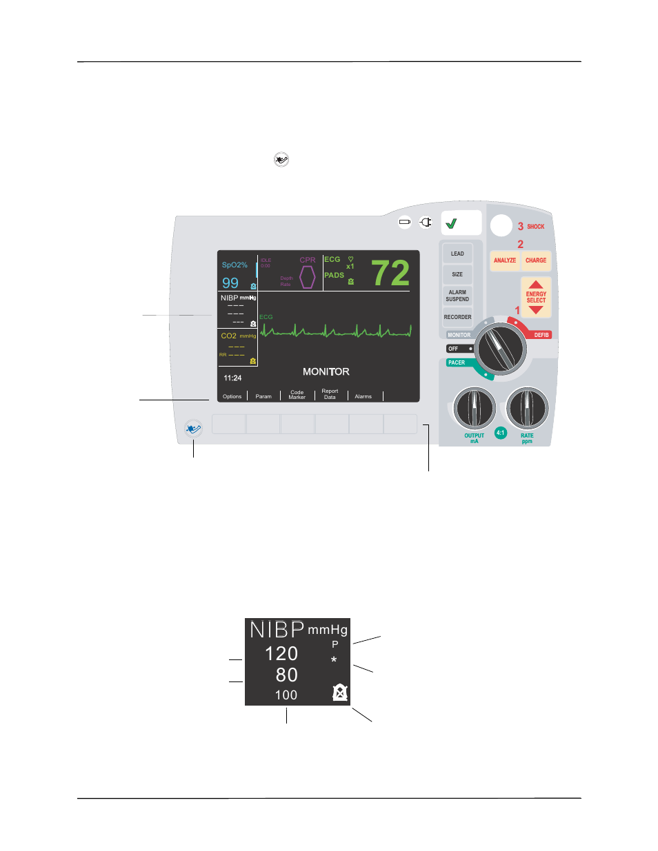 Nibp, Mmhg, How do i read the display | ZOLL R Series Monitor Defibrillator Rev A NIBP User Manual | Page 7 / 28