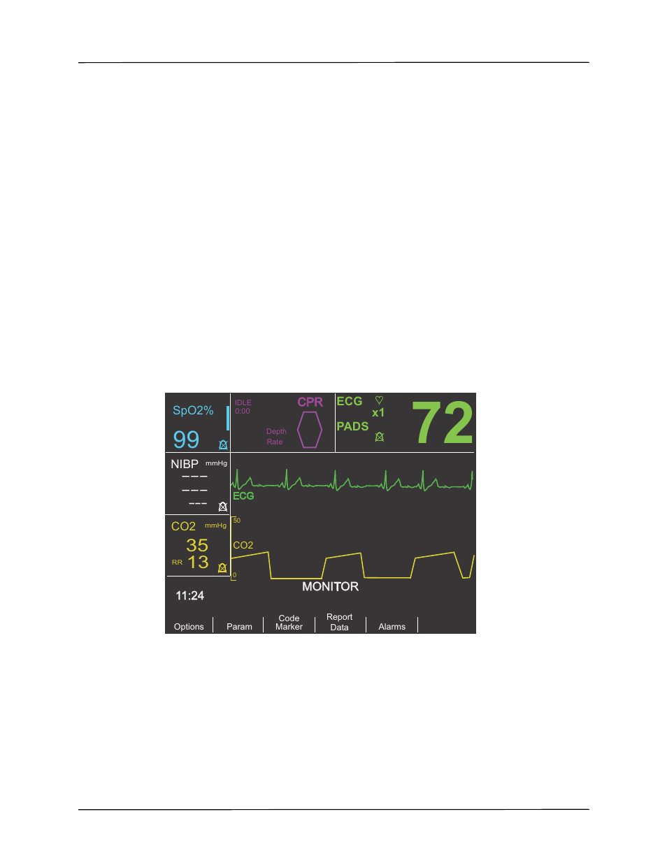 How etco, Is displayed, Displaying the capnogram waveform | ZOLL R Series Monitor Defibrillator Rev A ETCO2 User Manual | Page 11 / 22