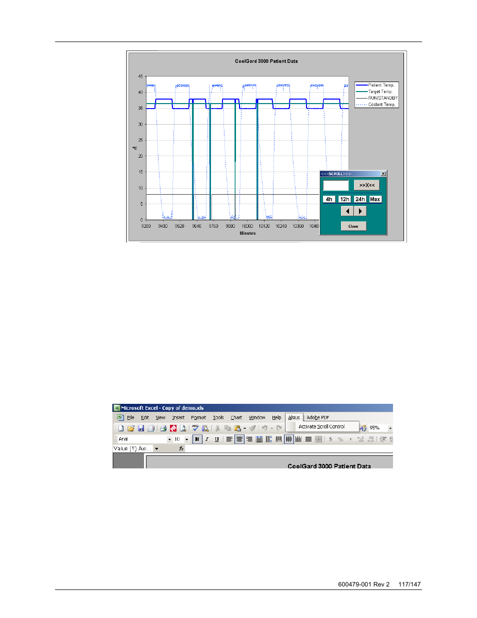 ZOLL Thermogard XP IVTM System Operation Manual User Manual | Page 117 / 147