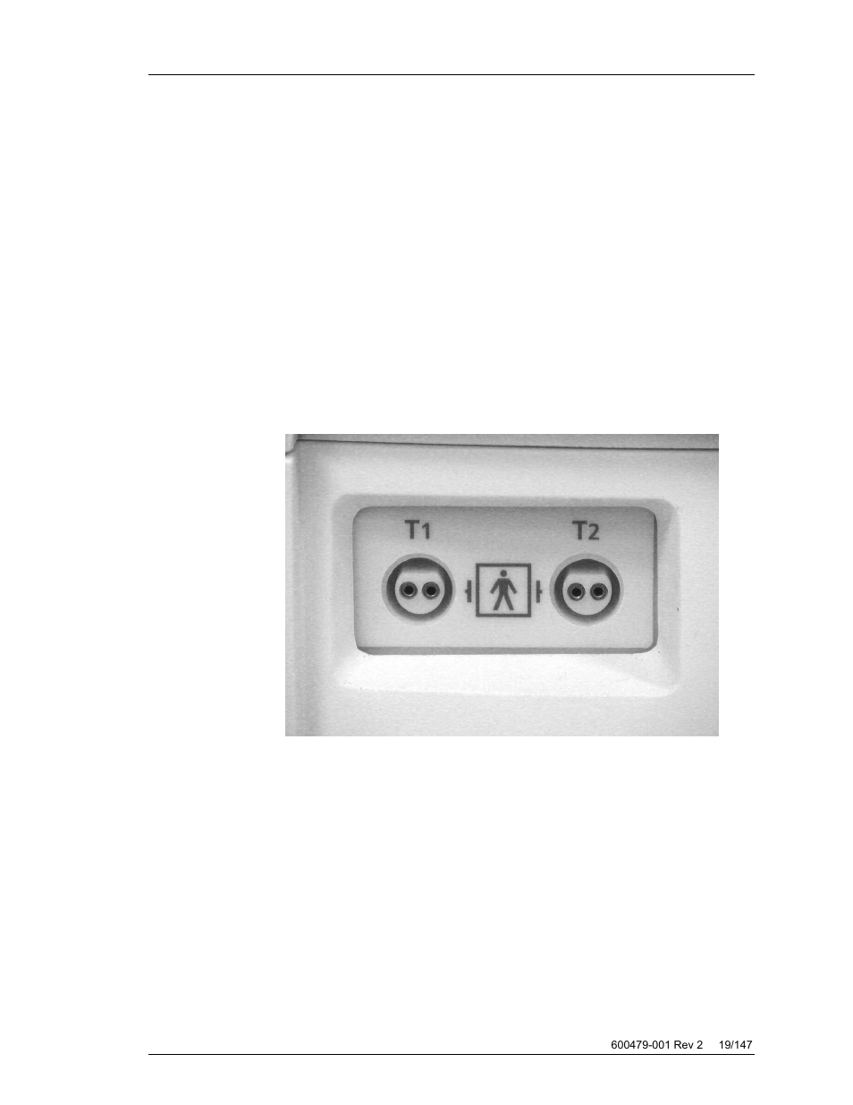 Temperature controller, Pump | ZOLL Thermogard XP IVTM System Operation Manual User Manual | Page 19 / 147