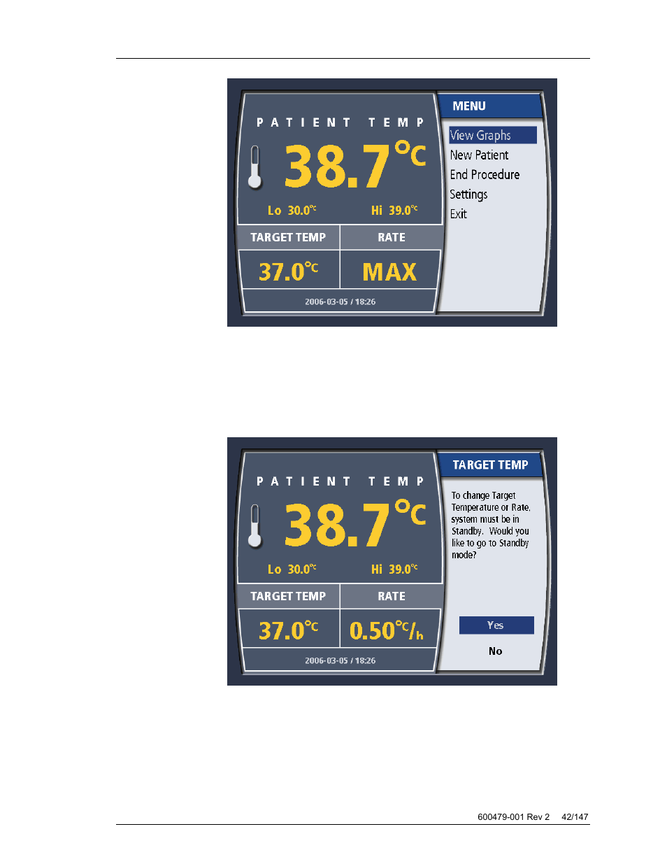 Changing target temperature | ZOLL Thermogard XP IVTM System Operation Manual User Manual | Page 42 / 147