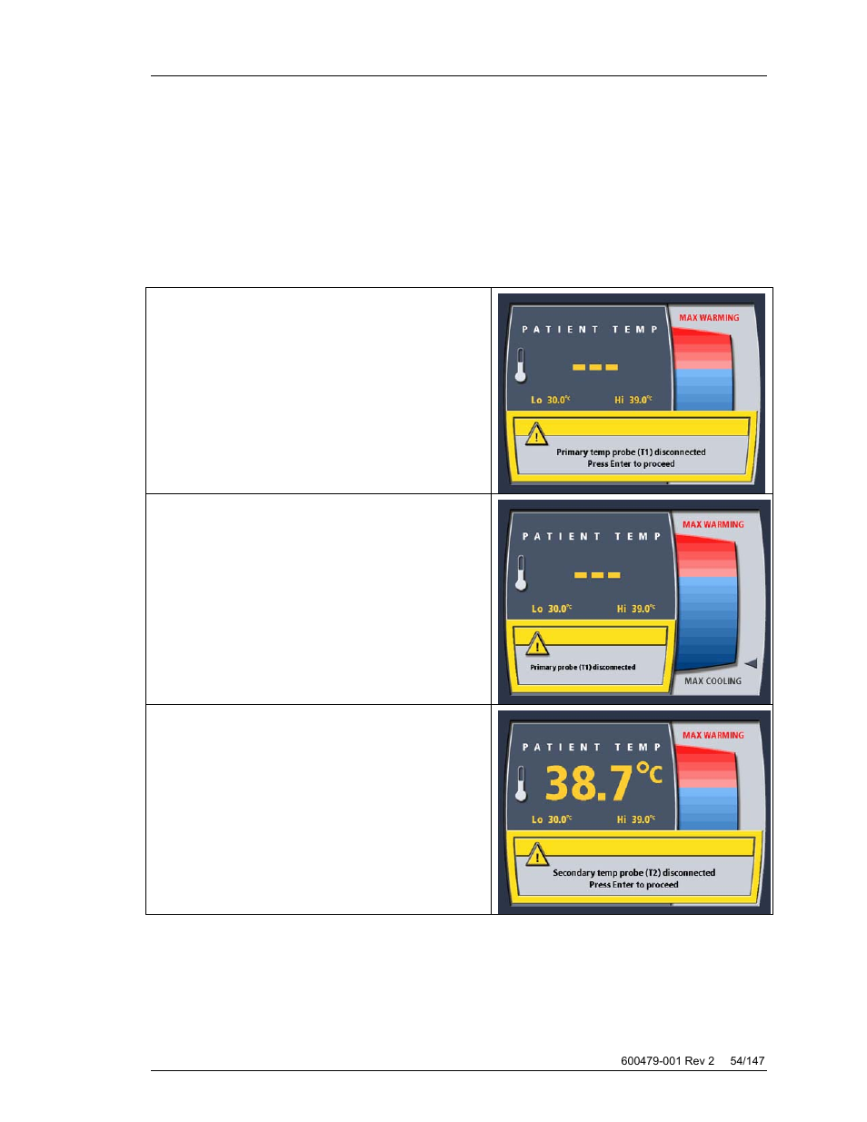 T2 probe disconnection/reconnection, Accidental disconnection t1/t2 probe | ZOLL Thermogard XP IVTM System Operation Manual User Manual | Page 54 / 147