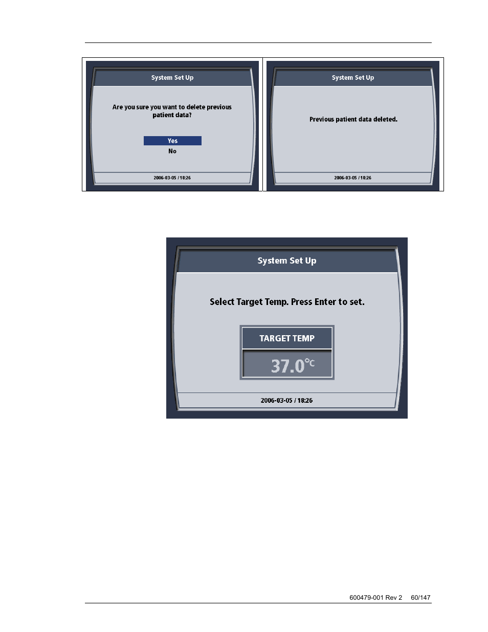 ZOLL Thermogard XP IVTM System Operation Manual User Manual | Page 60 / 147