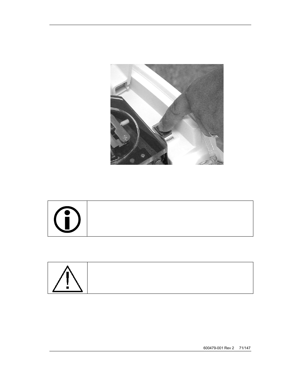 ZOLL Thermogard XP IVTM System Operation Manual User Manual | Page 71 / 147