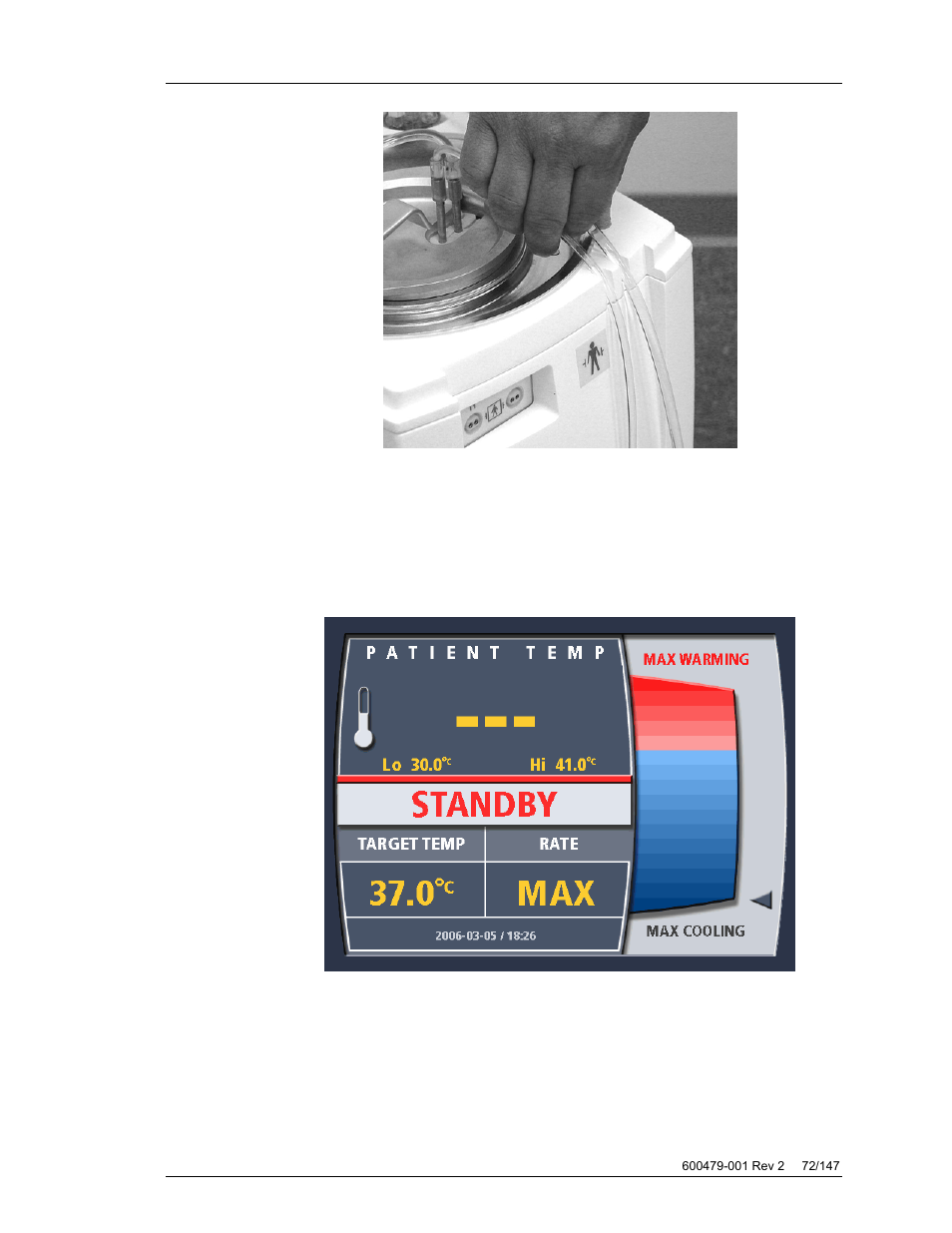 ZOLL Thermogard XP IVTM System Operation Manual User Manual | Page 72 / 147