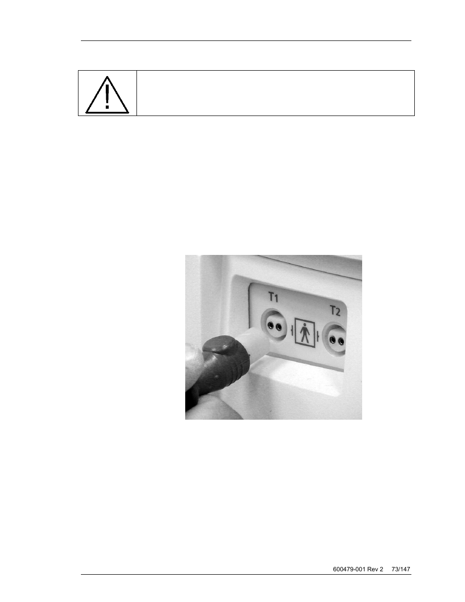 Connecting the patient to the system | ZOLL Thermogard XP IVTM System Operation Manual User Manual | Page 73 / 147