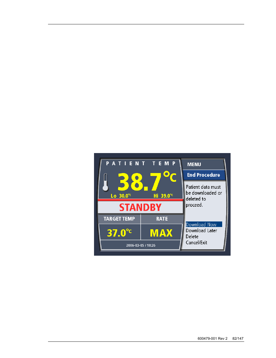 Ending treatment, End procedure, Data download | ZOLL Thermogard XP IVTM System Operation Manual User Manual | Page 82 / 147