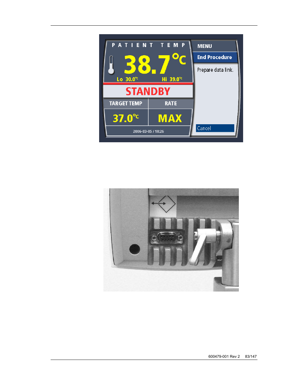 ZOLL Thermogard XP IVTM System Operation Manual User Manual | Page 83 / 147