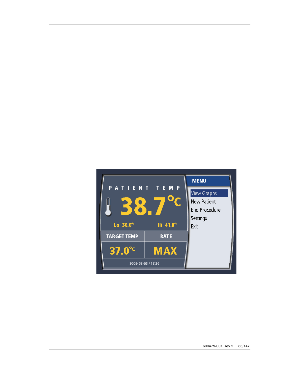 Temperature trend data, Overview, Displaying the temperature trend graph | ZOLL Thermogard XP IVTM System Operation Manual User Manual | Page 88 / 147