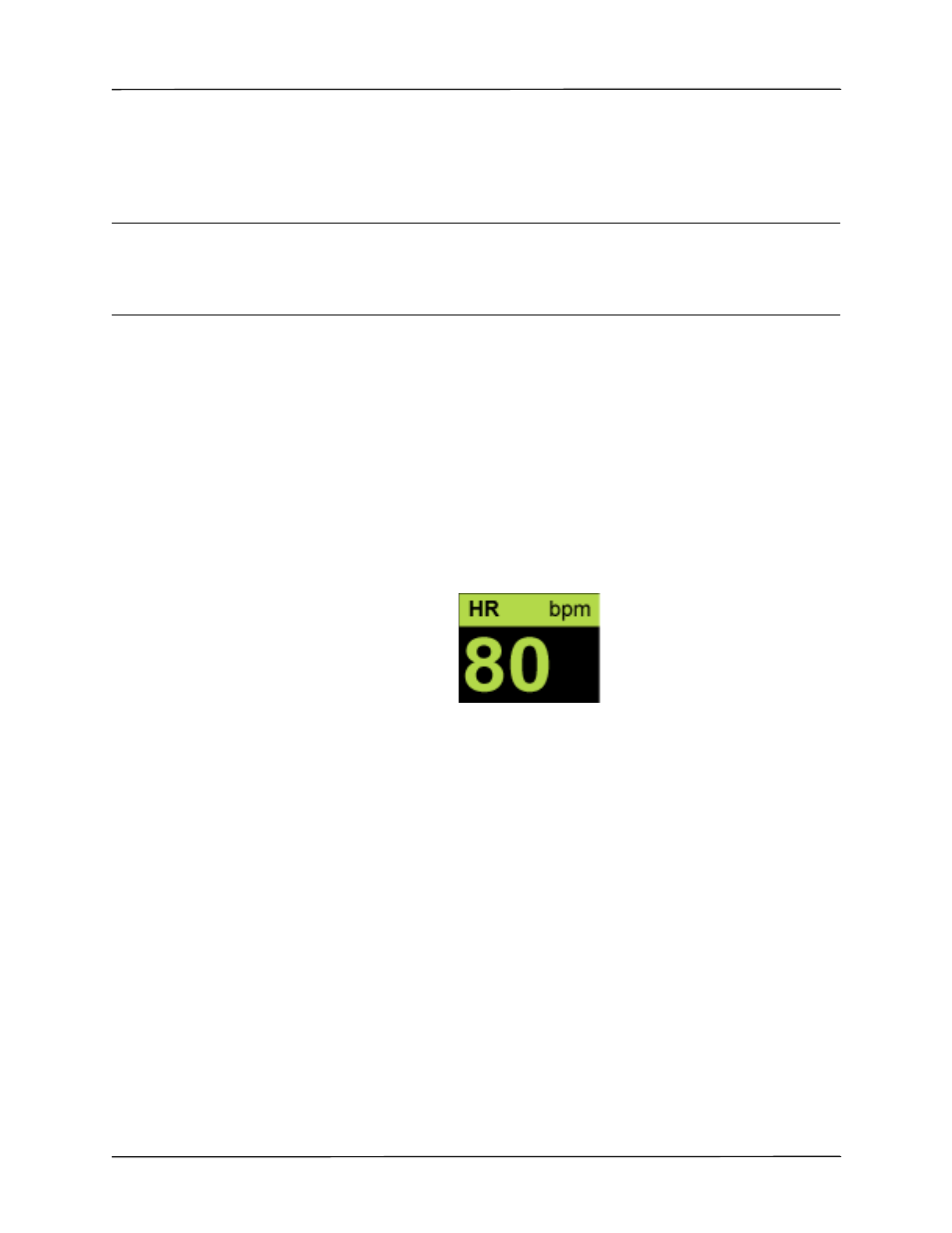 Heart rate meter, Configuring heart rate (hr) meter alarms | ZOLL X Series Monitor Defibrillator Rev H User Manual | Page 101 / 328