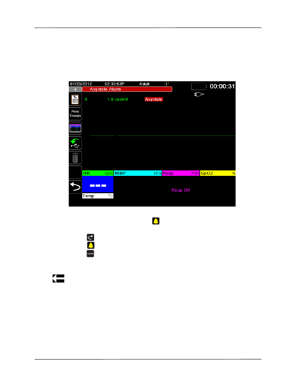 Life threatening rhythm alarms | ZOLL X Series Monitor Defibrillator Rev H User Manual | Page 103 / 328