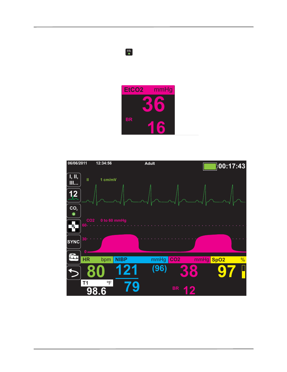 Measuring co | ZOLL X Series Monitor Defibrillator Rev H User Manual | Page 129 / 328