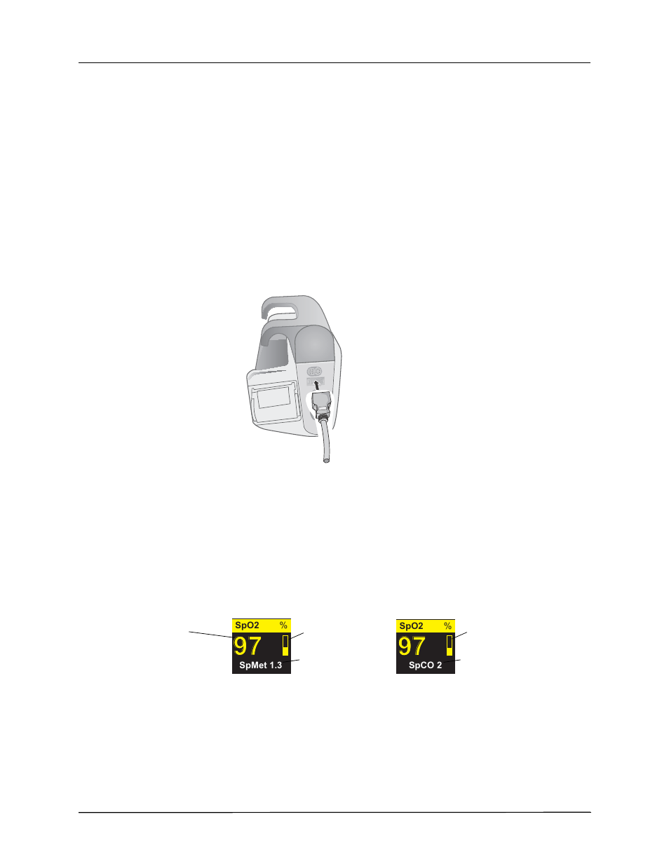 Connecting the spo, Sensor, Displaying spo | Spco, and spmet measurements, Cleaning and reuse of sensors | ZOLL X Series Monitor Defibrillator Rev H User Manual | Page 142 / 328