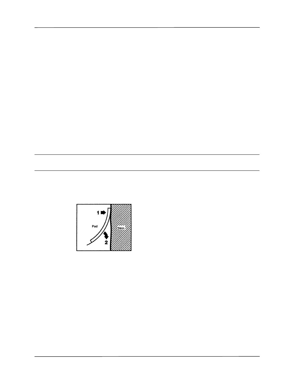 Prepare patient, 1 turn on unit | ZOLL X Series Monitor Defibrillator Rev H User Manual | Page 167 / 328