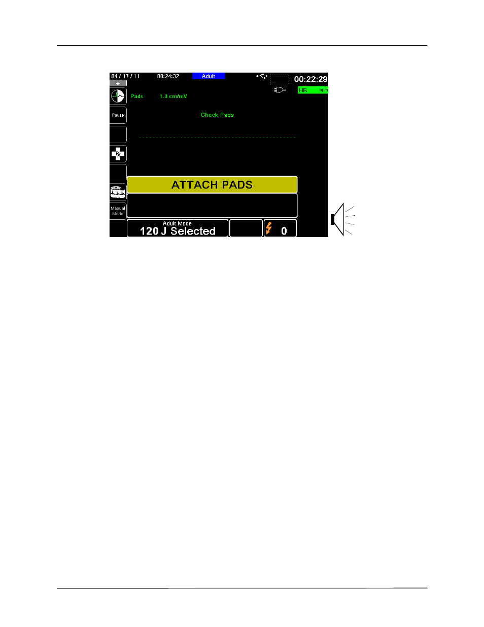 ZOLL X Series Monitor Defibrillator Rev H User Manual | Page 168 / 328