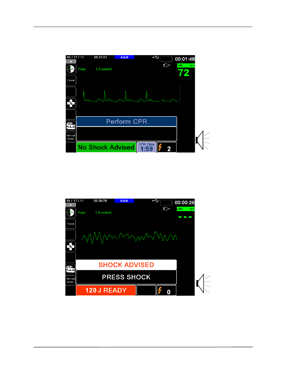 ZOLL X Series Monitor Defibrillator Rev H User Manual | Page 170 / 328