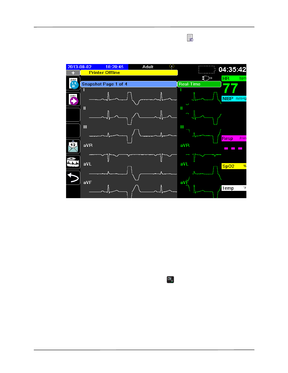 ZOLL X Series Monitor Defibrillator Rev H User Manual | Page 185 / 328